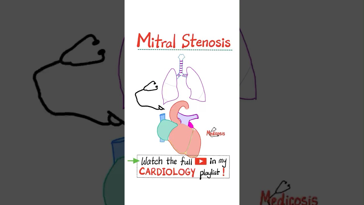 Mitral Stenosis (MS) - Valvular Heart Diseases (VHD)- Part 1 &hellip;#cardiology #cardio #anatomy #nurse