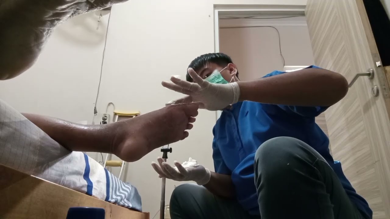 Kapan luka oprasi boleh kena air