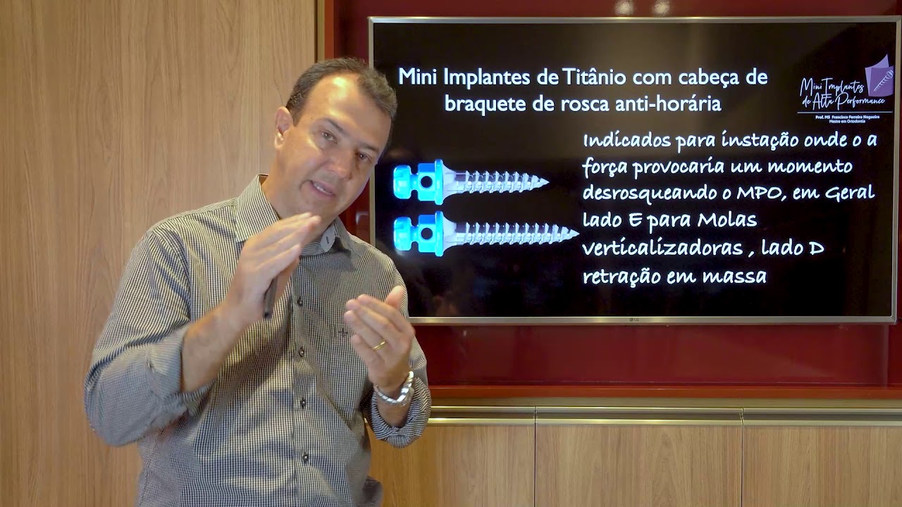Aula 8 e 9    Kit Mini implantes Morelli e  especificações  dos Mini implantes de Titânio Morelli.