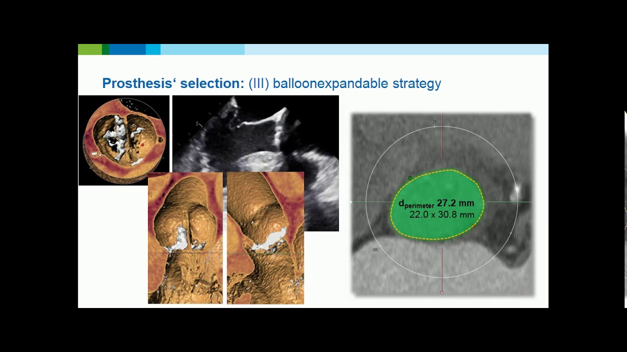 15.30-15.40: TAVR in Bicuspid Valves, Joerg Kempfert, MD