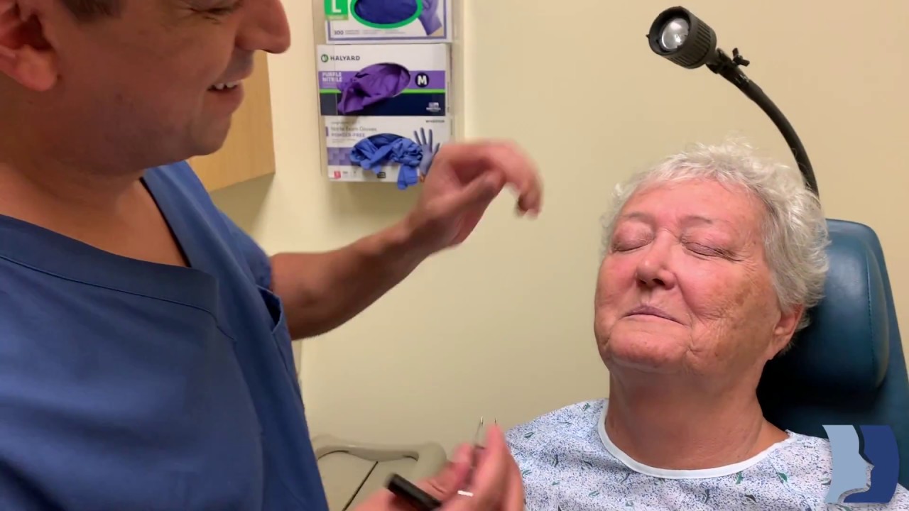 'The Pinch Method' - Eyelid Lift Pre-Op