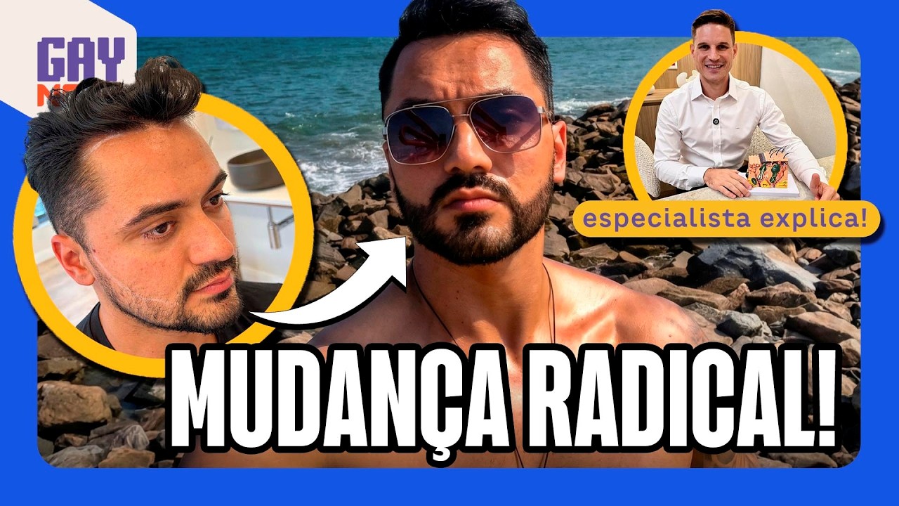 BARBA FALHADA tem jeito? Implante, minoxidil, xampu: médico explica tudo! │ GAY NERD