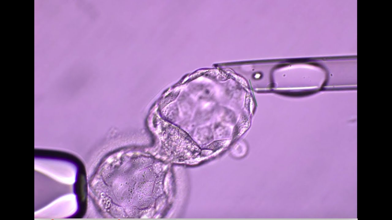 PGT TALK - Preimplantation Genetic Testing Process - Medfem Fertility Clinic