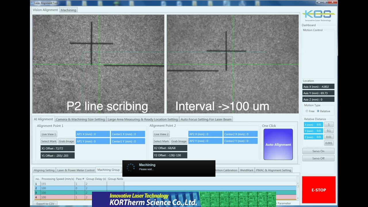 Vision Alignment for P1 P2 P3 Structuring