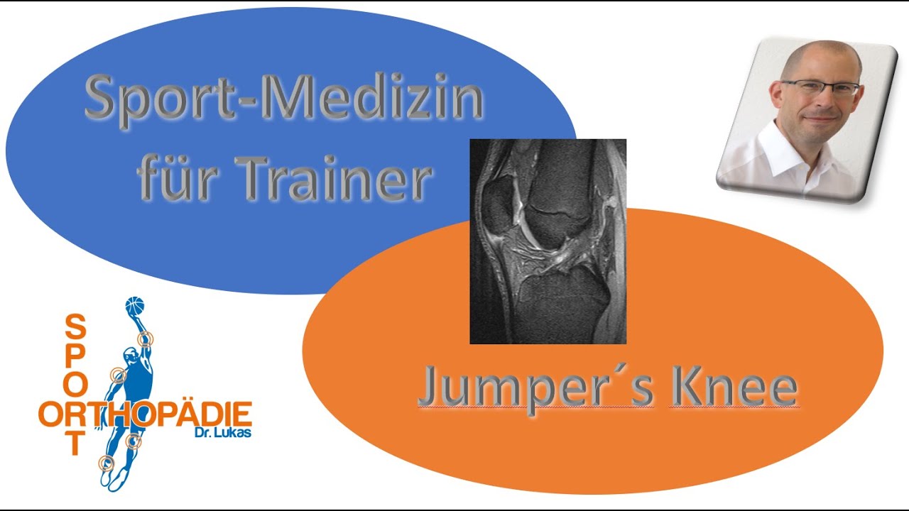 Volkskrankheit Patellaspitzensyndrom - Sportmedizin für Trainer
