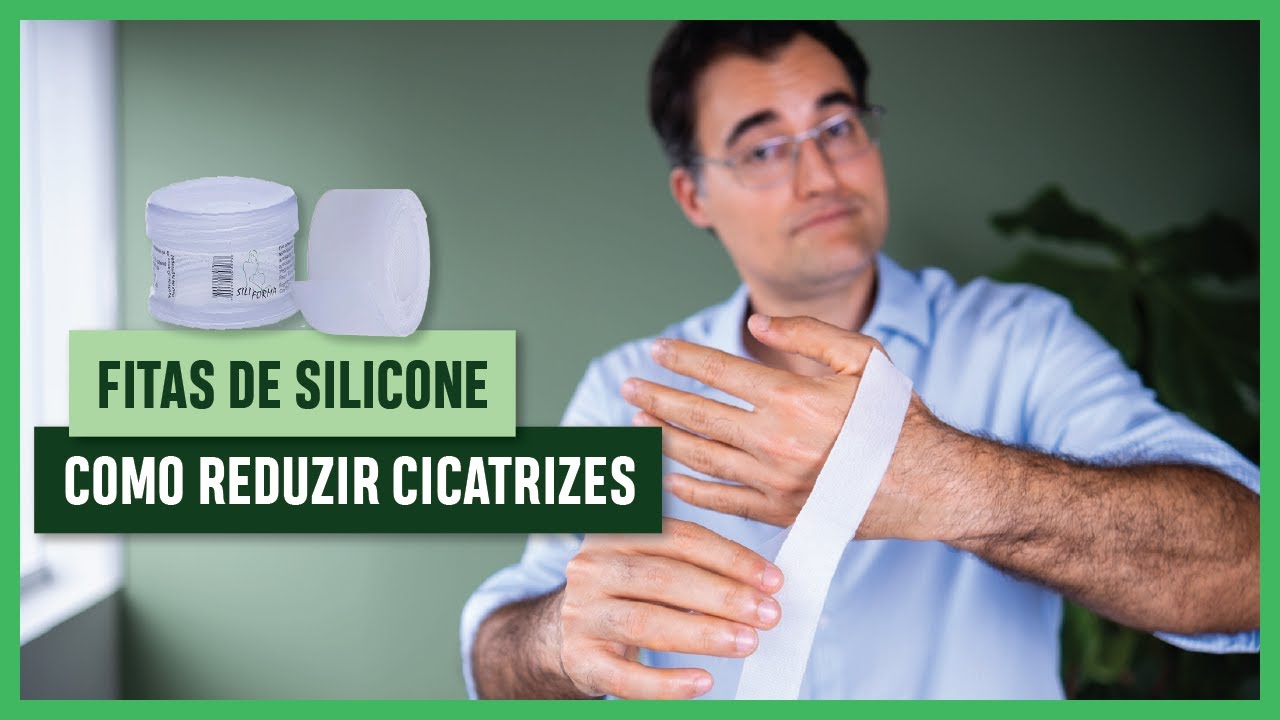 FITAS DE SILICONE: Solução de Como REDUZIR CICATRIZES Após Sua CIRURGIA PLÁSTICA.