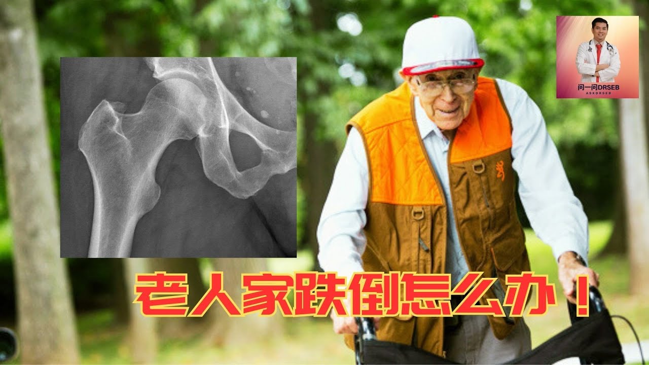 老人家跌倒怎么处理