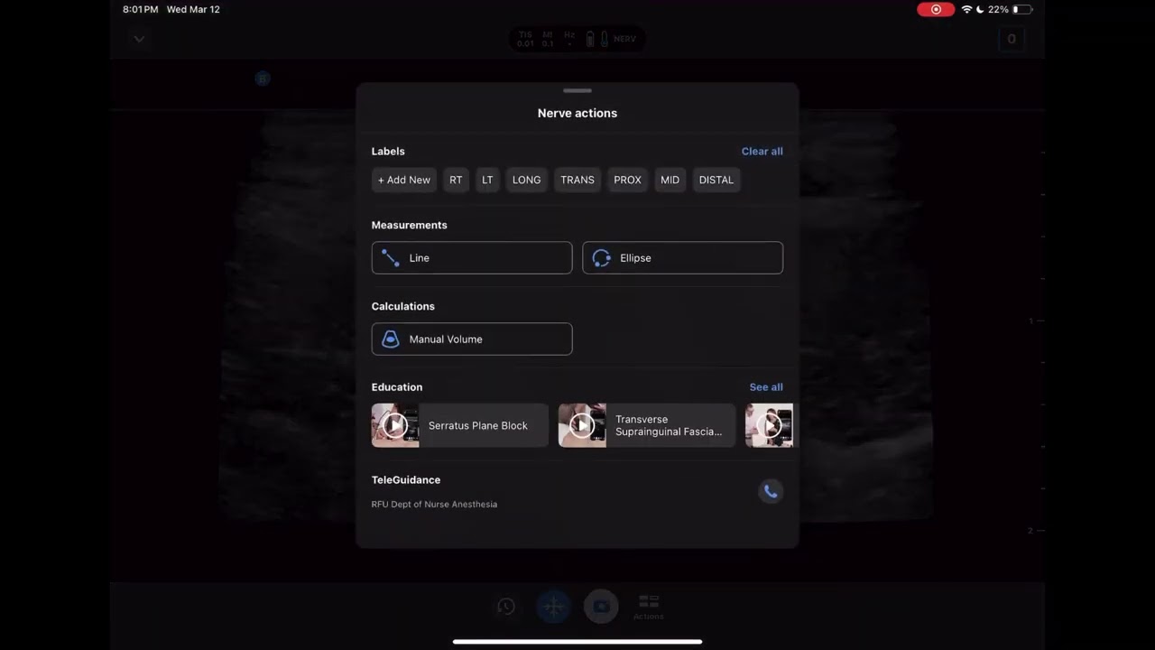 Butterfly US Basics Module 4
