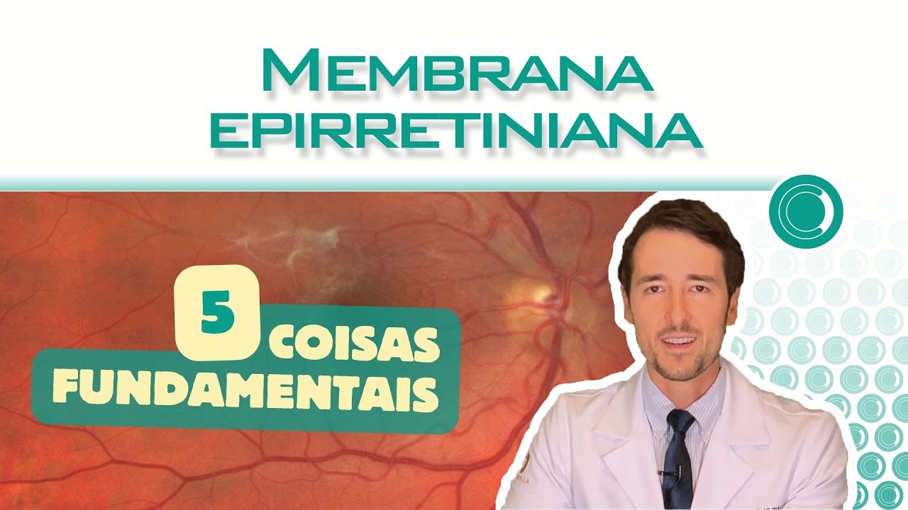 Membrana epirretiniana: veja antes de operar!