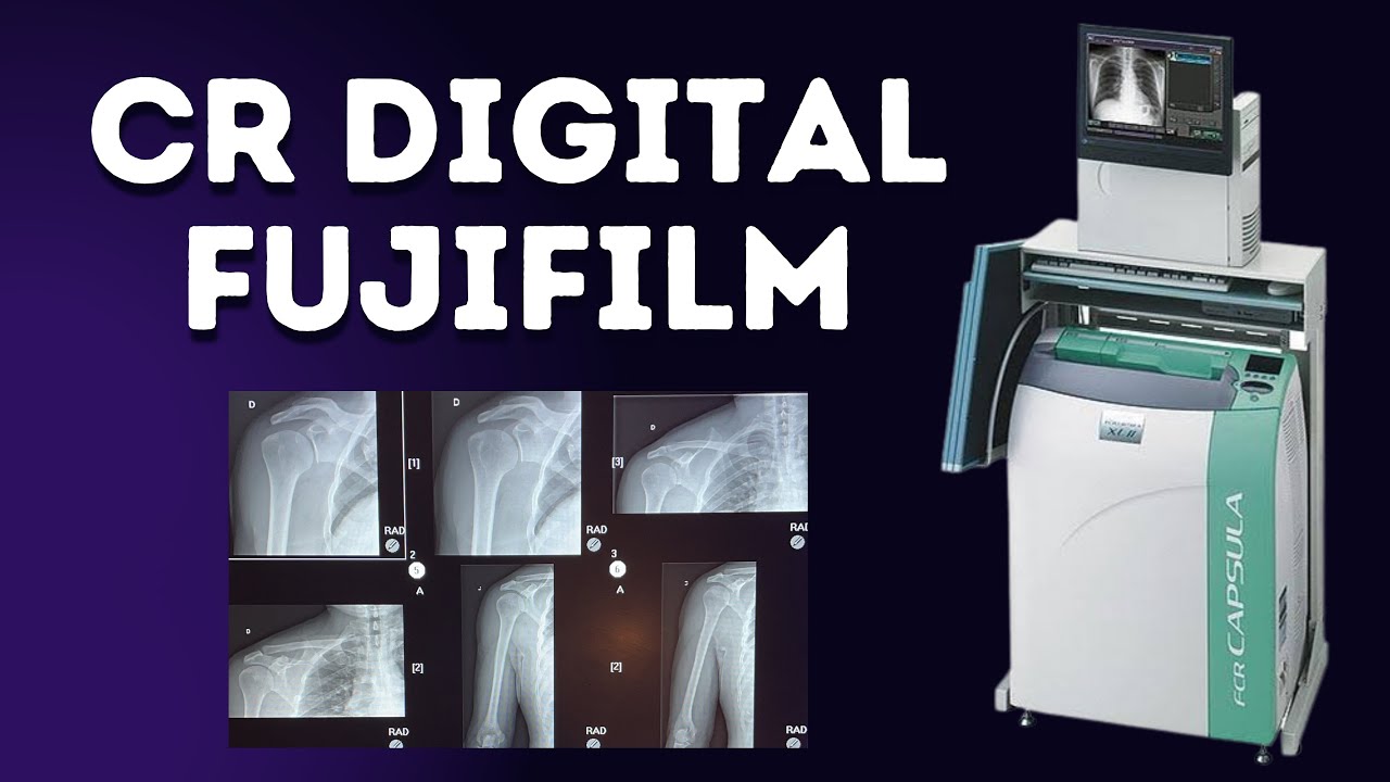 Sistema digital CR Fugifilm.                  RADIOLOGIA