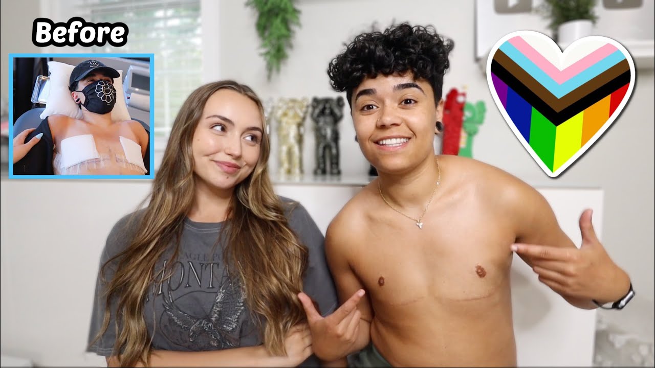 1 Year Post Top Surgery Update + Our Coming Out Stories