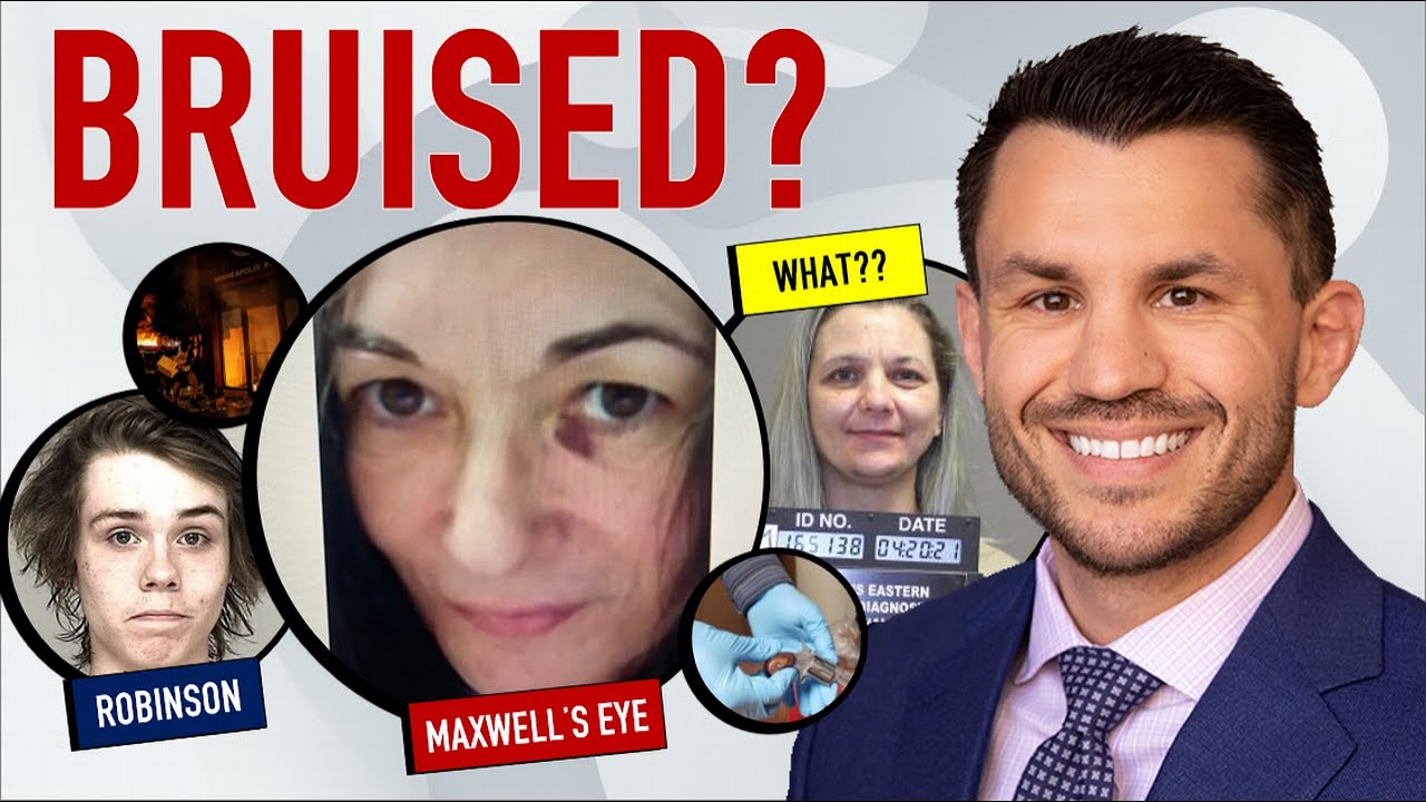 Floyd Firebomb Protestor Robinson Sentenced, Ghislaine Maxwell&rsquo;s Bruised Eye, DC AG Karl Racine