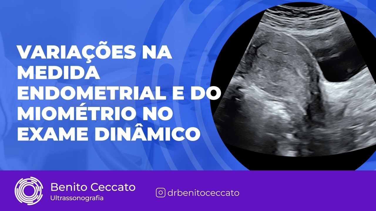 Variações na Medida Endometrial e do Miométrio no Exame Dinâmico