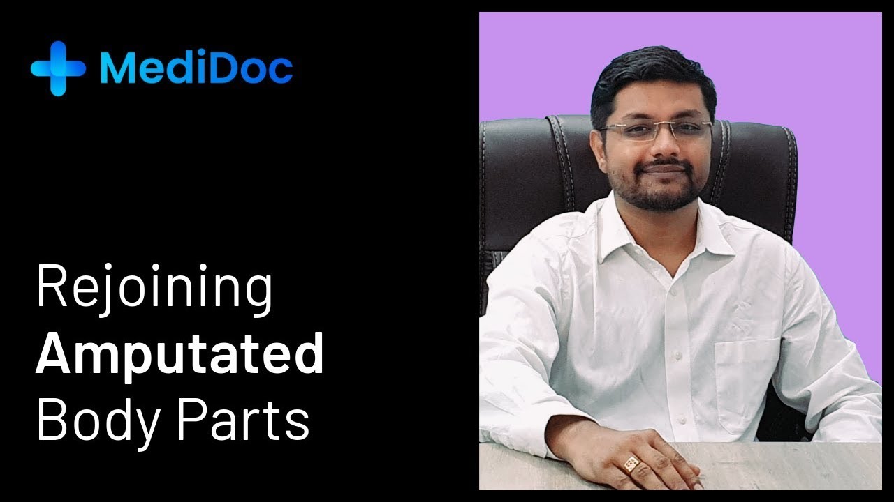 Rejoining Amputed Body Parts | MediDoc | Myths and Facts | EP - 02 |