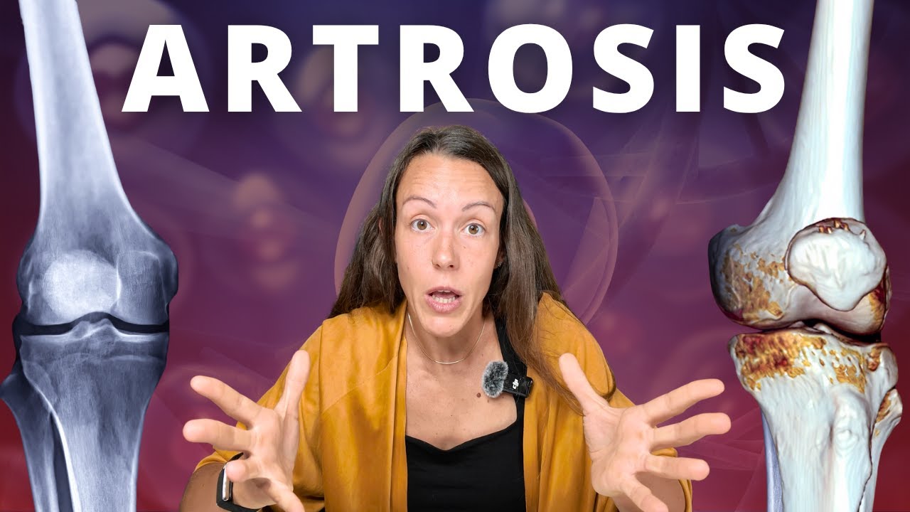 ARTROSIS: Cómo Aliviar Tu DOLOR Sin Fármacos
