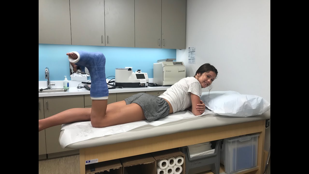MY FIRST LEG CAST?!?!