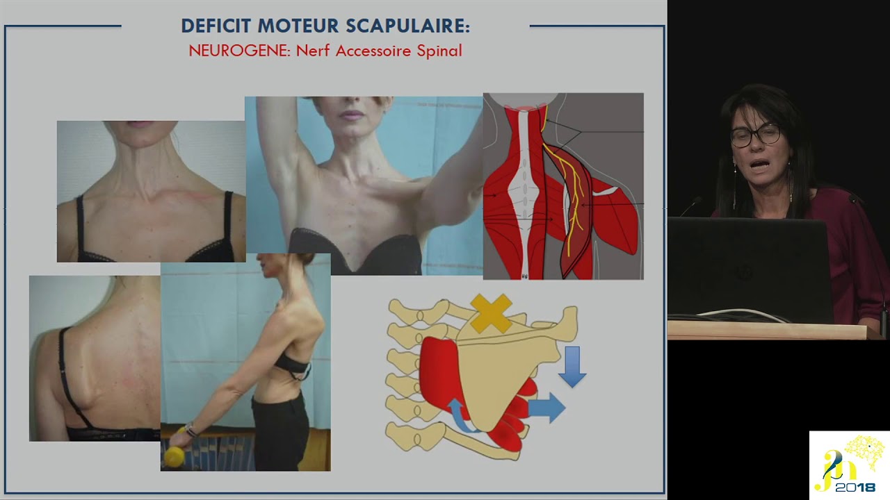 J2N 2018 - Session - Myasthénie et myopathies