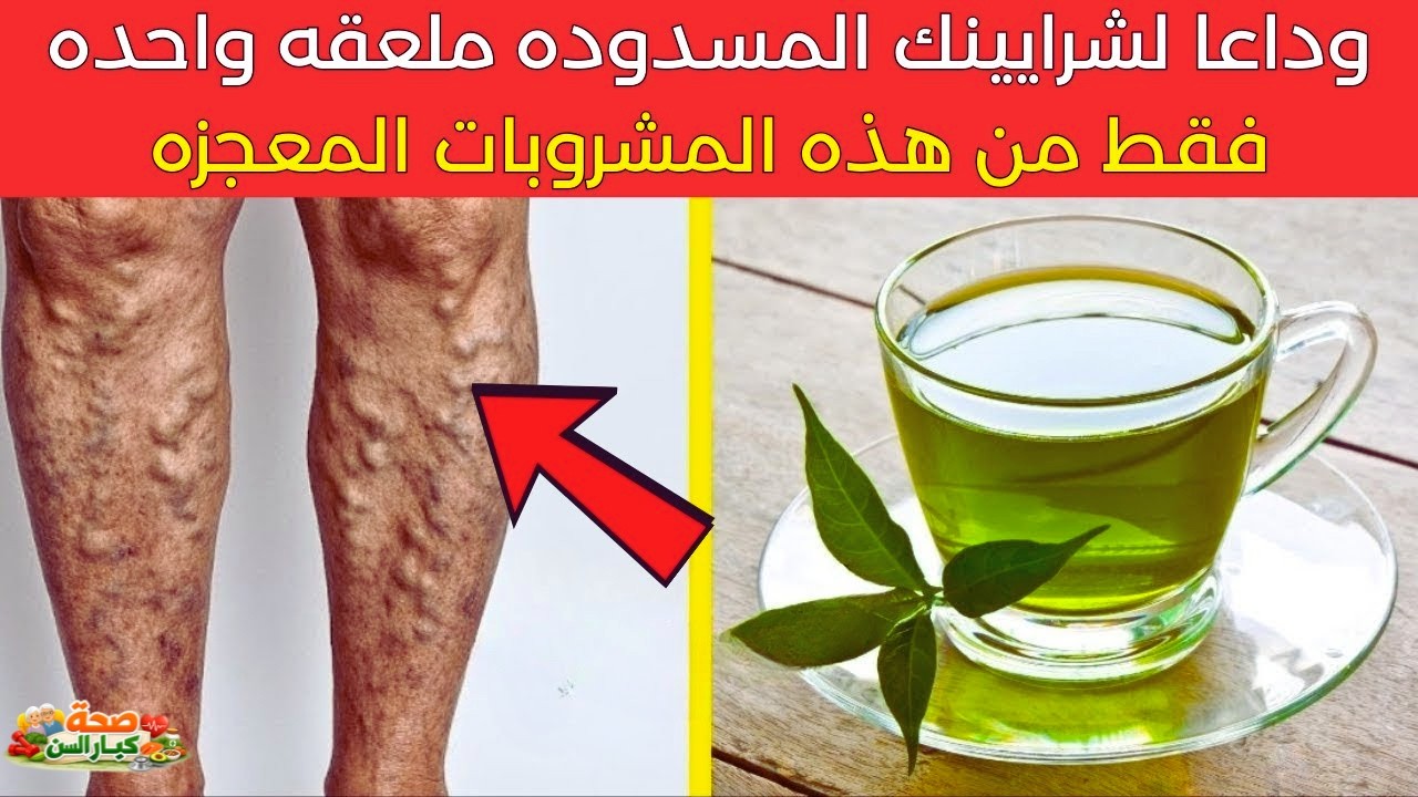 فوق سن الستين! قل وداعًا لانسداد الشرايين بهذه الخطوة البسيطة التي يتجاهلها الكثيرون