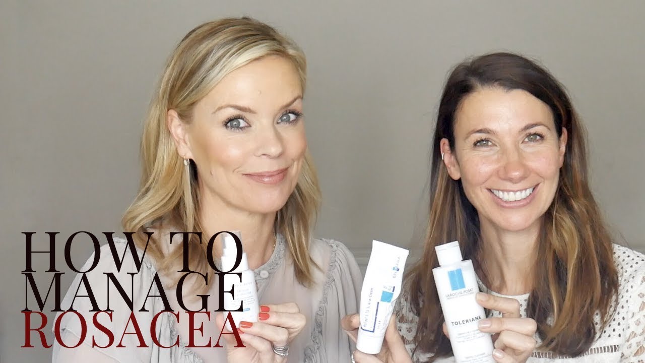 How to manage Rosacea with Rosie Green