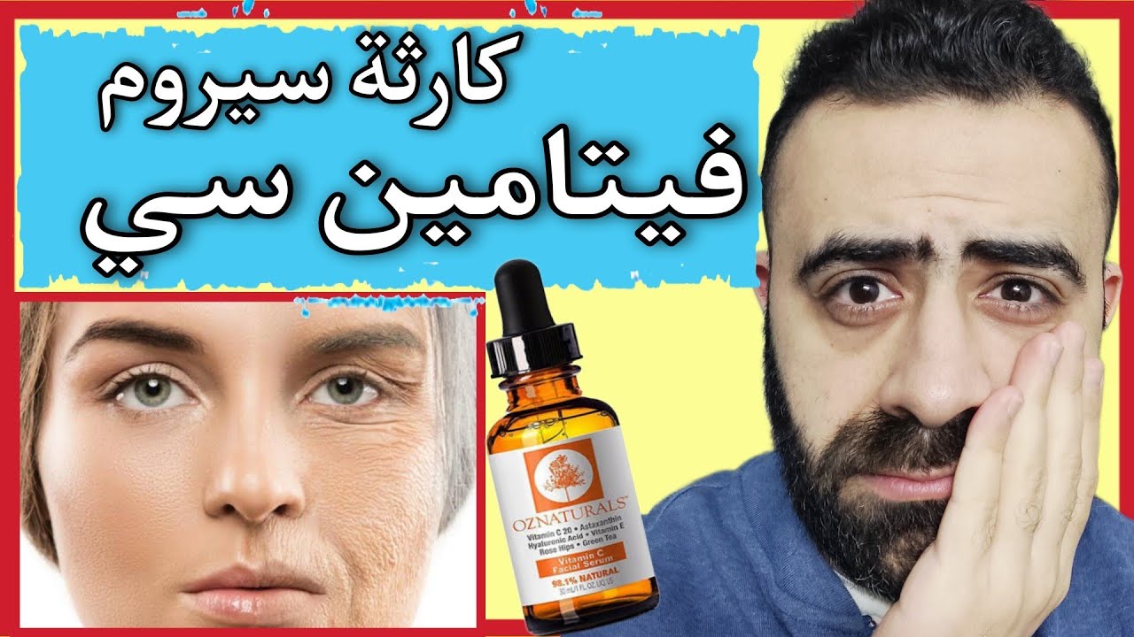 تحذير هام اياك من سيروم فيتامين سي الذي يروج له علي يوتيوب و تيك توك لنضارة و شد البشرة