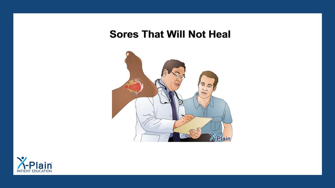 Sores That Will Not Heal