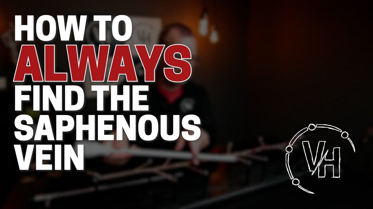 How to ALWAYS find the saphenous vein during EVH
