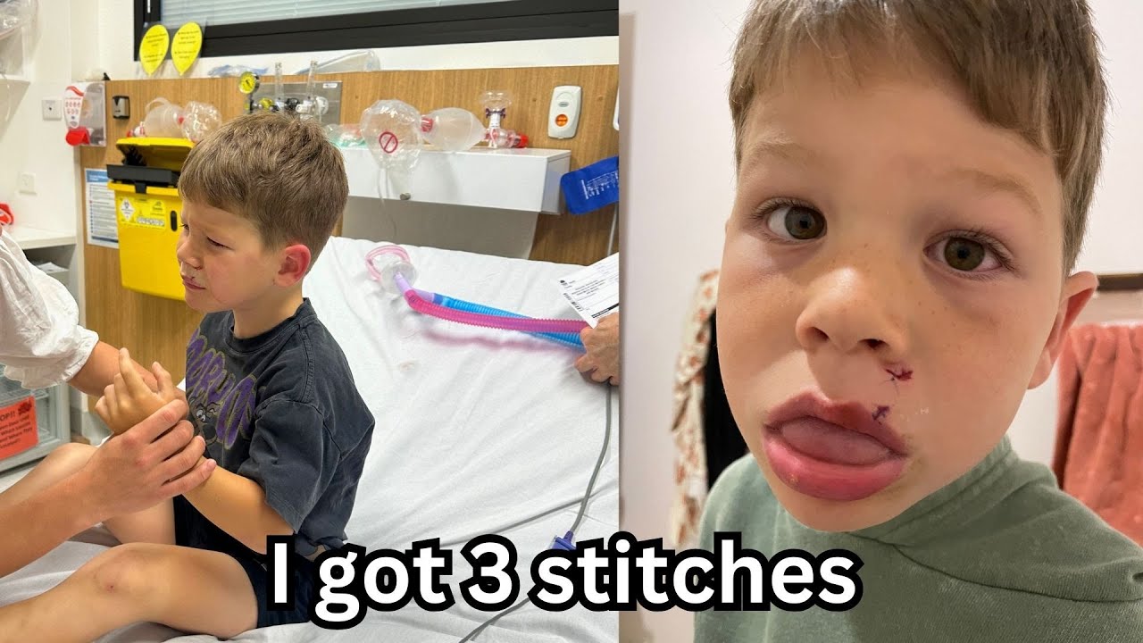 I got 3 stitches and might lose my tooth!