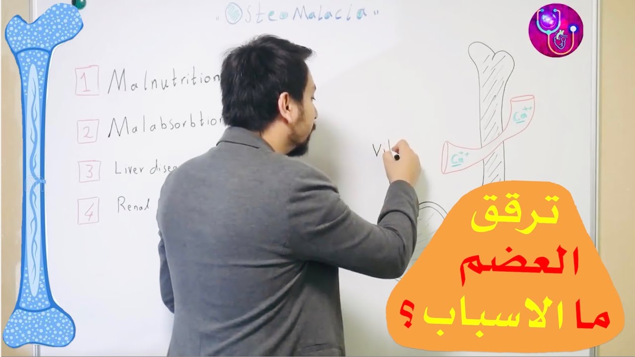 اسباب ضعف العضام Osteomalacia