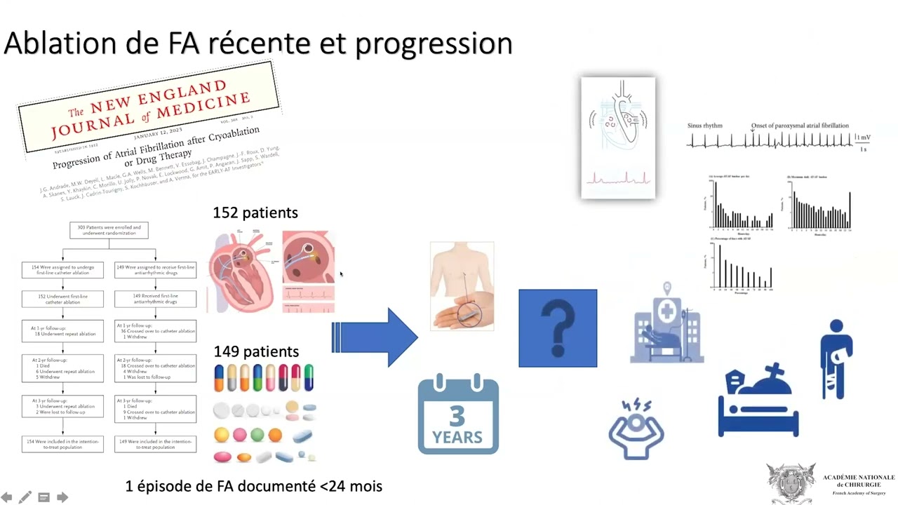 Indication de l'ablation précoce dans la fibrillation auriculaire