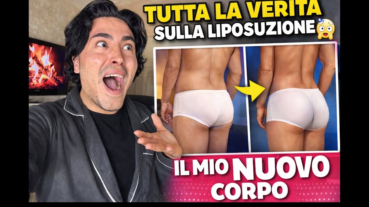 TUTTA LA VERITÀ SULLA MIA LIPOSUZIONE 😱 ECCO IL MIO NUOVO CORPO! Su Instagram e tiktok luckyy_JOHN c