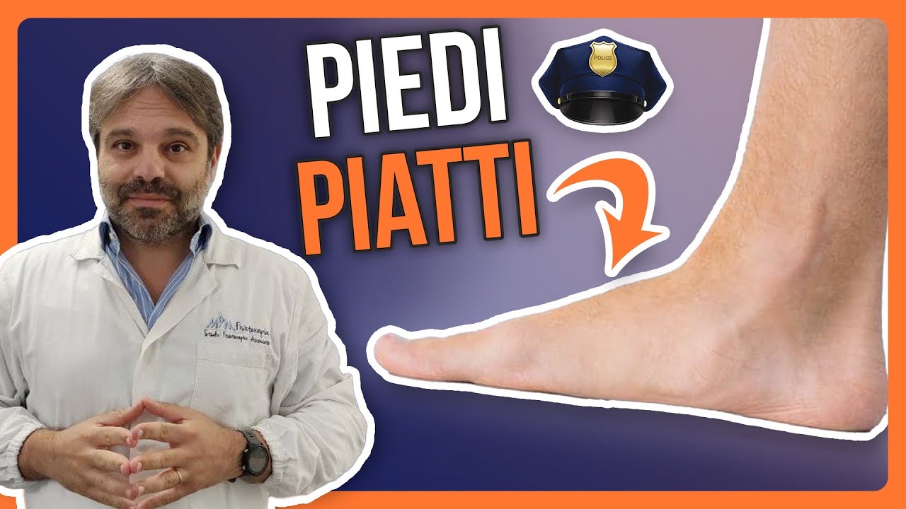 PIEDE PIATTO | COSA È, come CURARLO