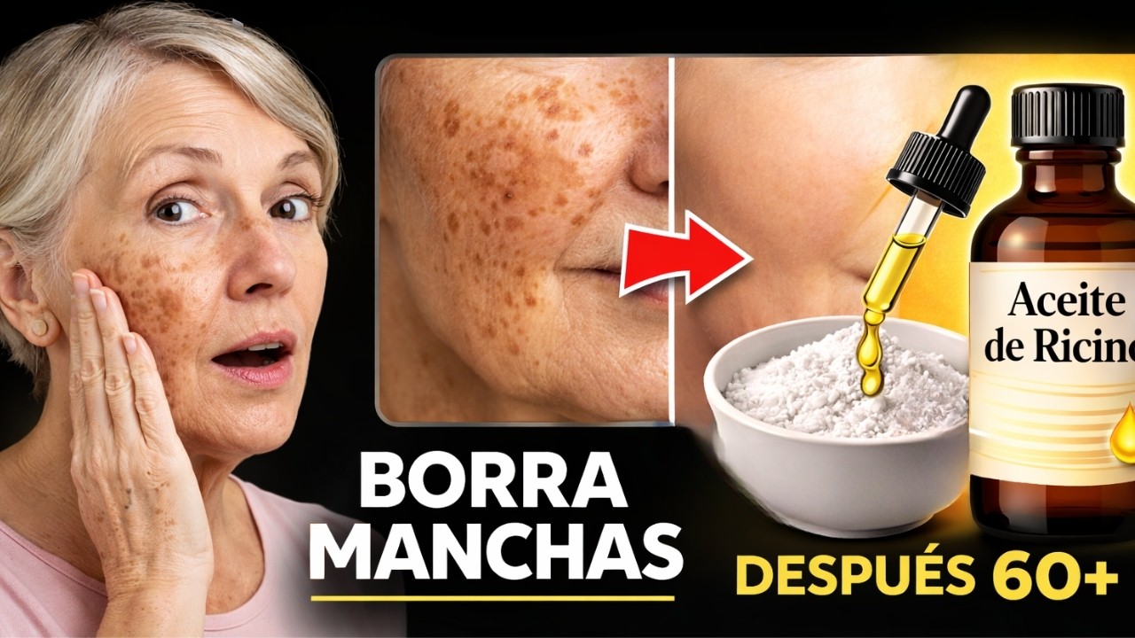 Aceite de Ricino y Bicarbonato: Borra las Manchas de la Edad en Semanas