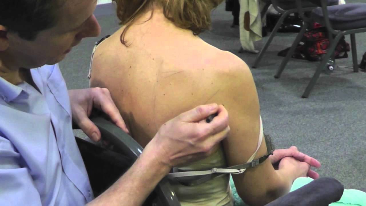 The Bowen Technique. Shoulder Procedure
