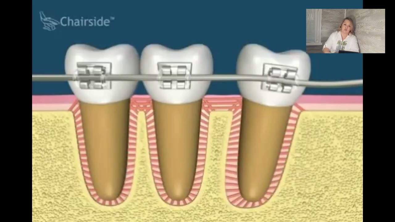 Биомеханика ортодонтического лечения
