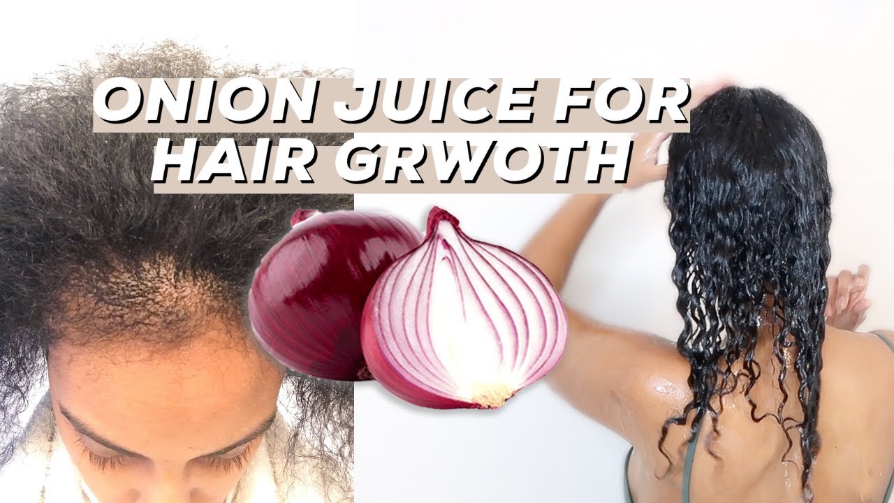 ONION JUICE FOR HAIR GROWTH *how I make onion juice for EXTREME HAIR GROWTH* update video