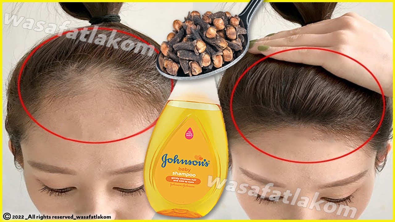 Put these ingredients in your shampoo, 🌾 it accelerates hair growth and treats baldness