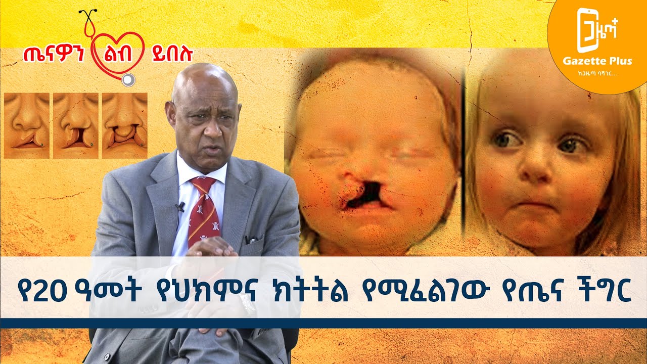 Ethiopia - ⚠️ የላንቃ እና የከንፈር መሰንጠቅ: 20 ዓመት የሚያስፈልገው የጤና ክትትል