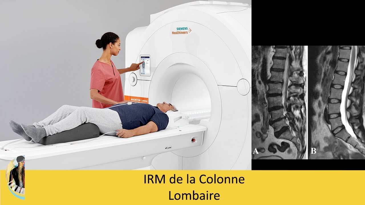 IRM de la Colonne Lombaire