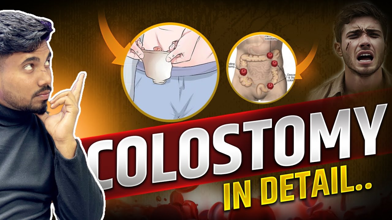 Colostomy Procedure & Nursing Care | Nursing Notes for Semester 3/MSN-1 #nursingwale #3rdsemester