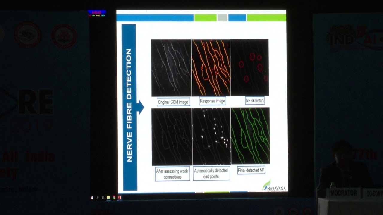 AIOC2019 FP453 Cornea III Analysis of Confocal Microscopy Using A Novel Software in Healthy..