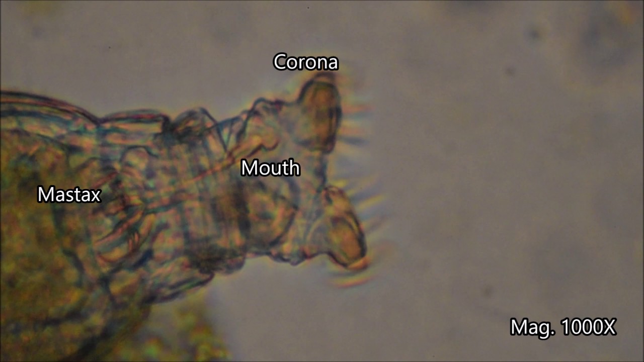 Rotifers under the microscope