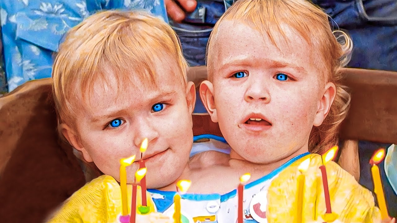 Two heads, one body and a heartbreaking story