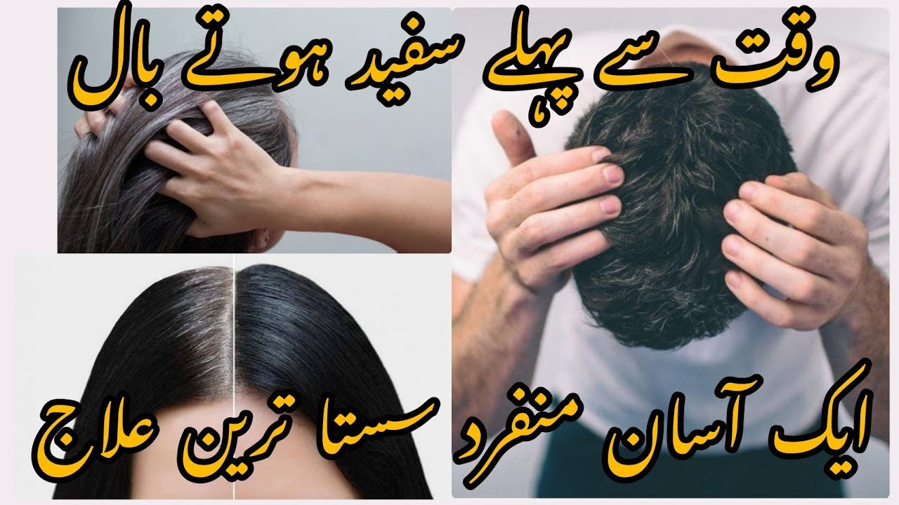Premature Grey Hair treatment/Safeed Balon Ko Kala Karny Ka Aasan Or Munfarid Tarika