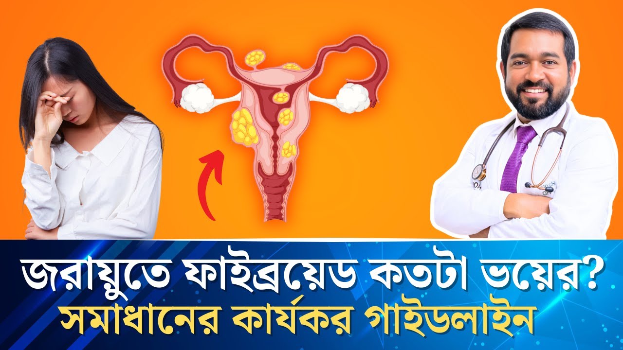জরায়ু ফাইব্রয়েডের কারণ, লক্ষণ ও ড. হকের প্রাকৃতিক চিকিৎসা