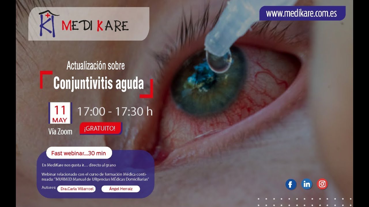Webinar #18/43: Conjuntivitis aguda