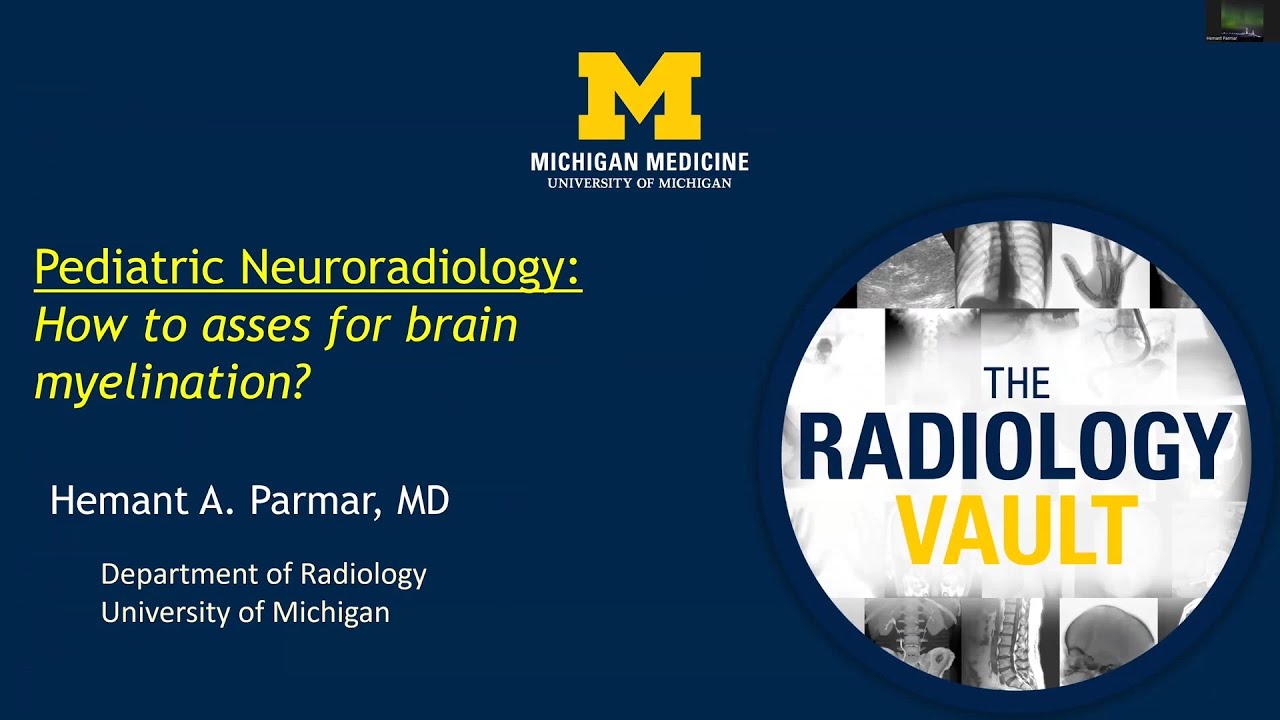 MRI & CT of Brain Myelination