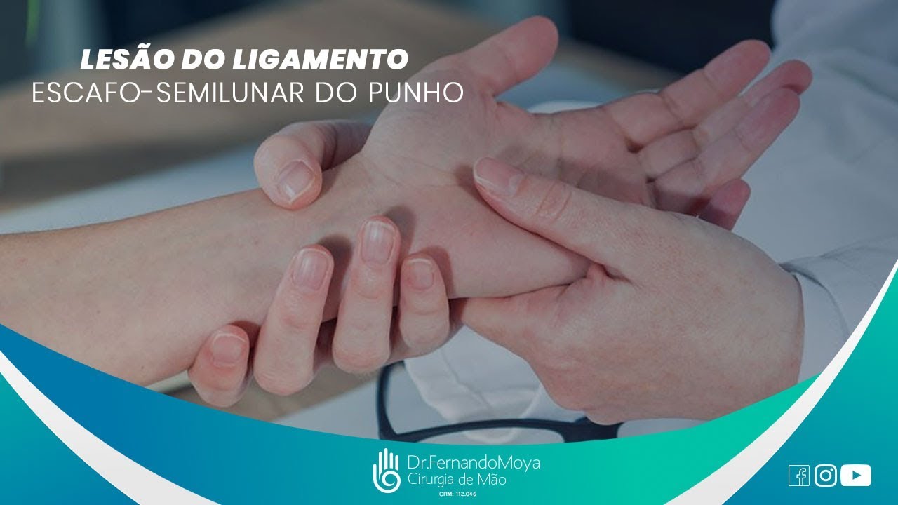 Lesão do Ligamento Escafo-semilunar do Punho: o que é e tratamento | Dr. Fernando Moya CRM 112.046