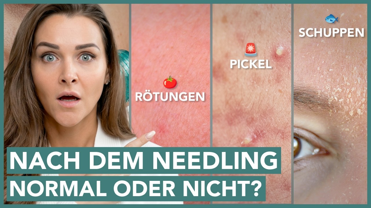 Rötung, Brennen, Schuppen nach dem Needling – normal oder Alarmzeichen? 🚨