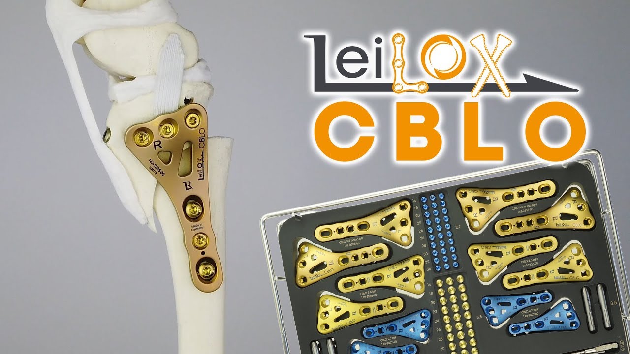 CBLO - Titanium Locking Implants by Rita Leibinger