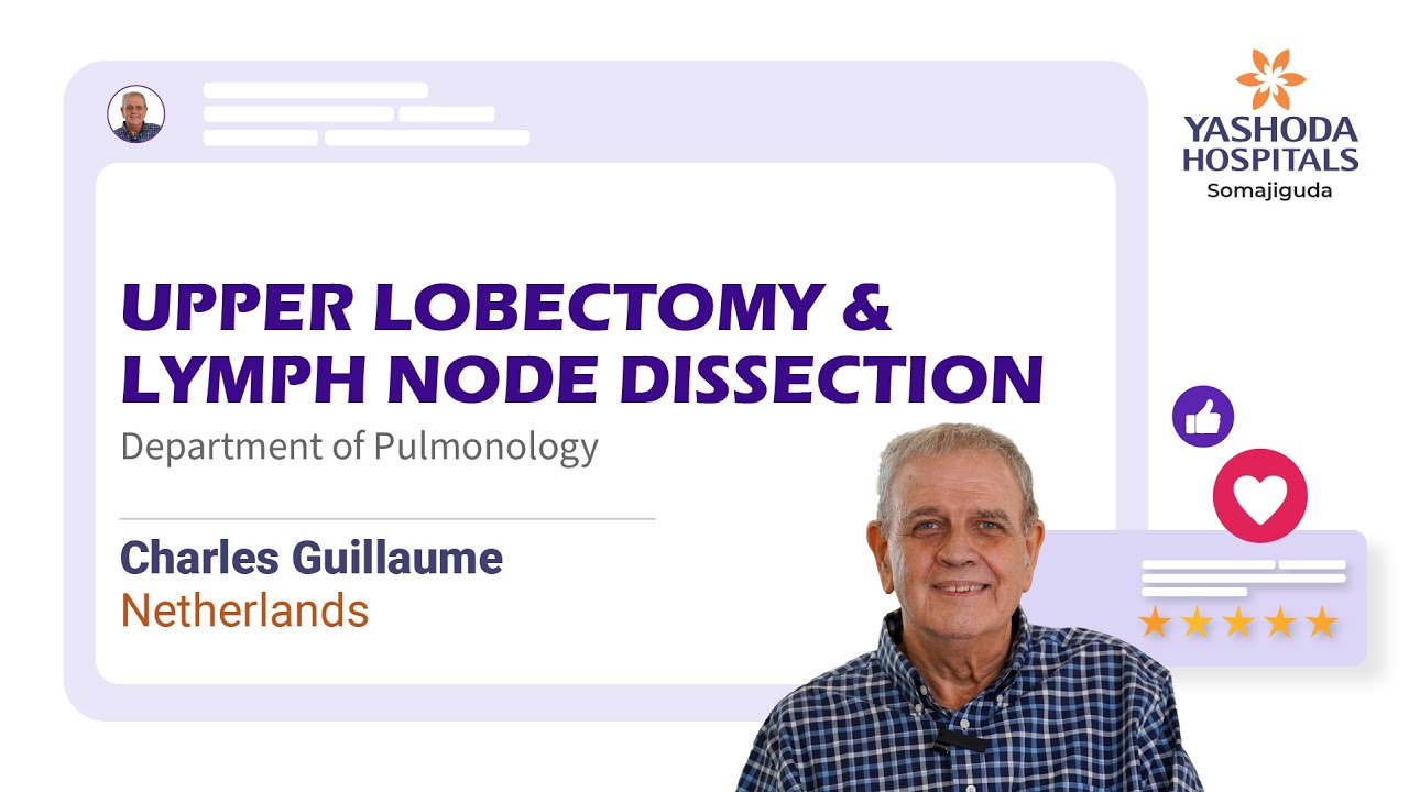 Upper Lobectomy & Lymph Node Dissection | Treatment for Left Upper Lobe and Hilar Mass